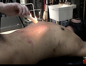 Torturedboy Fire and Wax Play